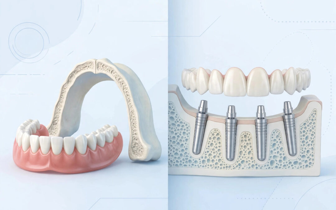 Dental Implants vs Dentures in Citrus Heights: Comfort, Cost & Longevity